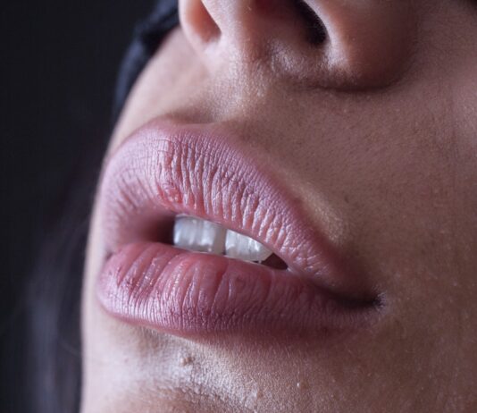 “아무리 바르고 발라도 입술이 갈라져요”… 만성 입술건조, 영양 결핍 신호일 수 있습니다 person with red lipstick and black mascara